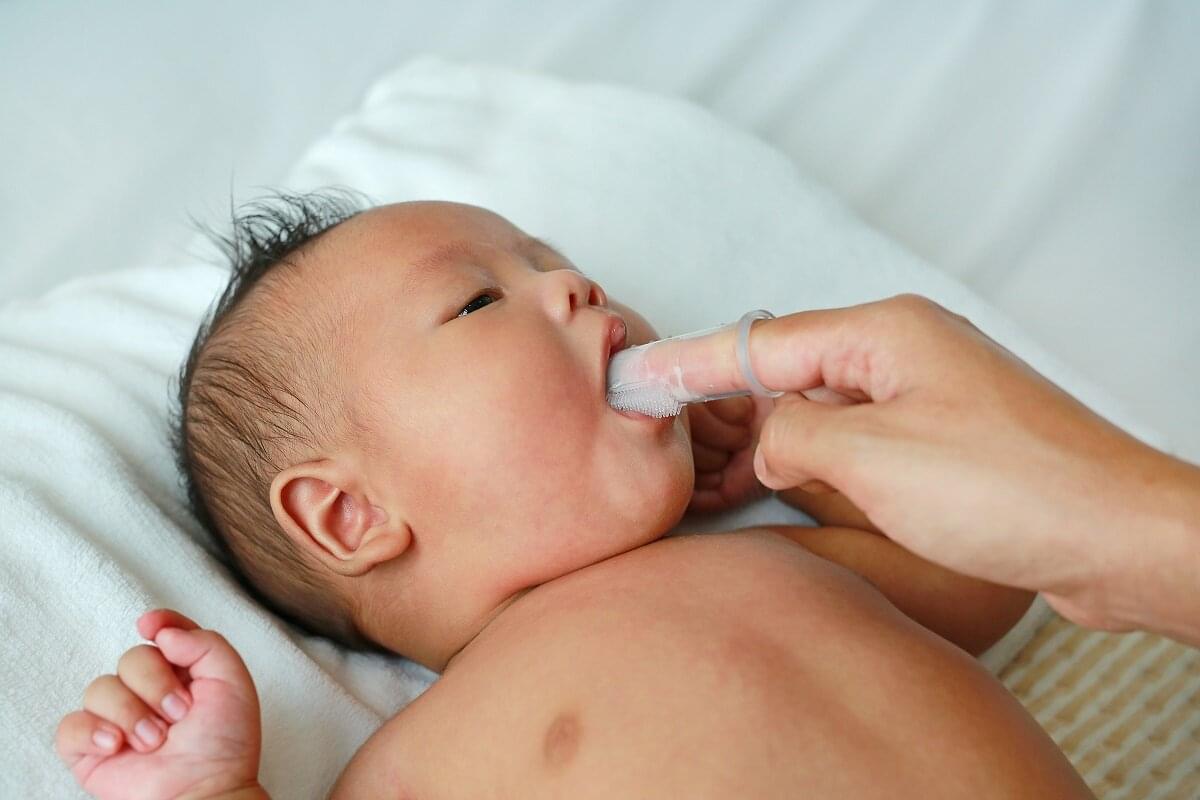 Соска на язык у новорожденного