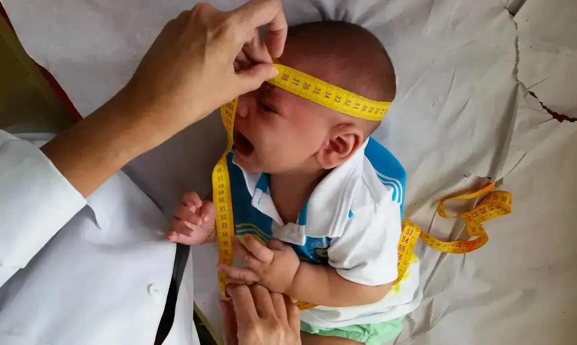 Médico medindo a cabeça de bebê para avaliação de microcefalia causada pelo vírus zika.