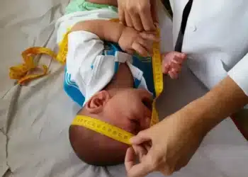 Imagem destacada Novo benefício do INSS ampara crianças com sequelas do Zika: veja valores e como solicitar