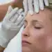 Imagem destacada Botox no rosto: há idade certa ou cada pele conta uma história?